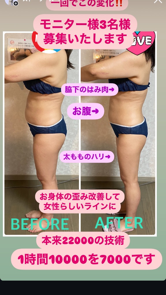クイック軟部リンパのモニター様募集のお知らせ