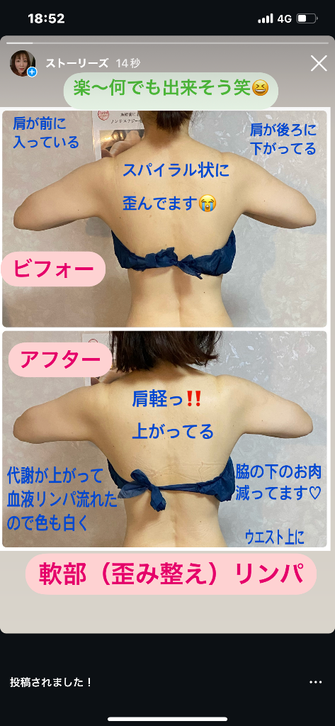 軟部リンパマッサージ（歪み調整）お客様ご感想